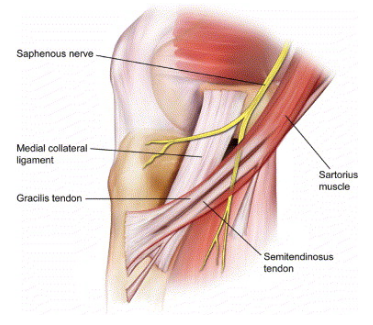 Figure 1 - a look at the medial knee and the relationship between the Medial collateral ligament and the portion of the hamstrings where the common hamstring graft is taken from. 